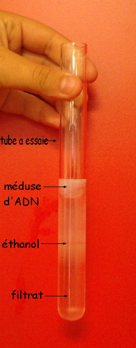 tubeessaie